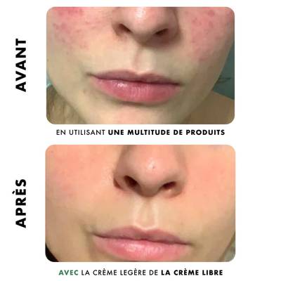 3770017889727 - La Crème Libre - Nettoyant Purifiant Anti-Imperfections - Peaux Mixtes à Grasses